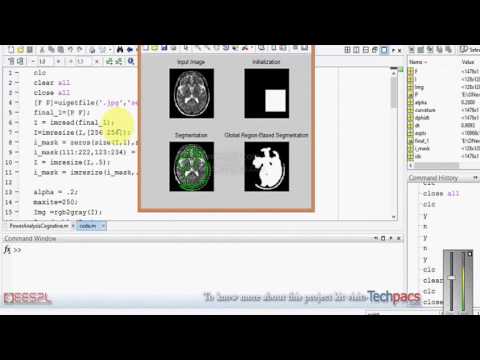 Contour model classification of  image segmentation with segment classifier approach(latest Project)