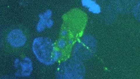 Caught on Camera: How HIV Infects Cells