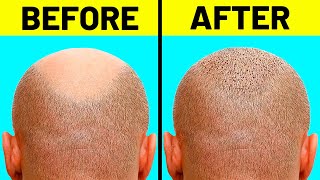 10 Easy Ways To Naturally Regrow Your Hair by INFORAMA 782 views 1 year ago 10 minutes, 35 seconds