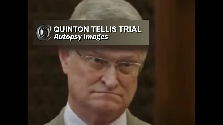 QUINTON TELLIS TRIAL -  Dr Hickerson (Autopsy pics) (2017)