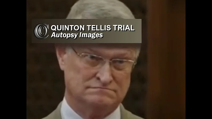 QUINTON TELLIS TRIAL -  Dr Hickerson (Autopsy pics...