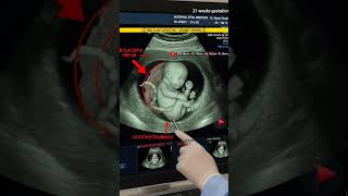 42 Weeks Pregnant? Don’t Ignore THESE Signs 🚨