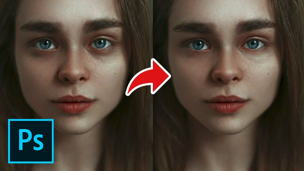 How to Remove Dark Circles (Eye Bags) Under Eyes in YouTube