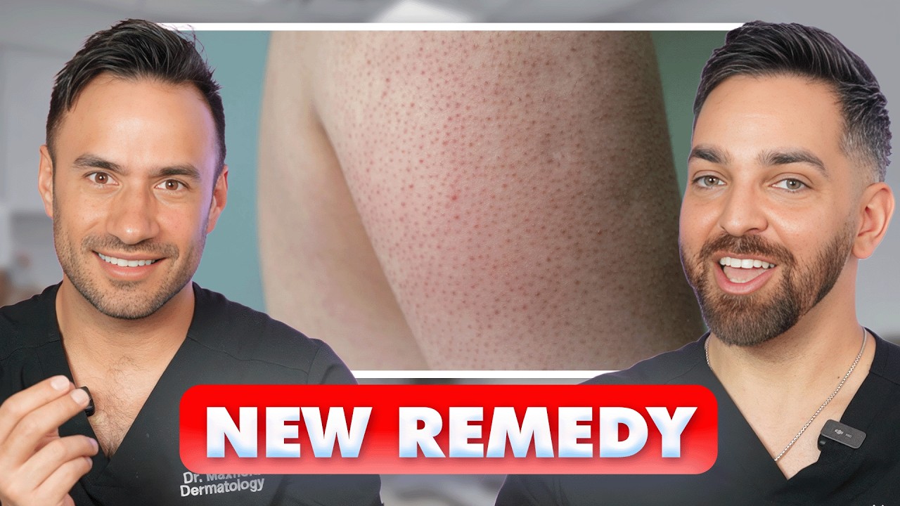 Watch on YouTube: KERATOSIS PILARIS? STRAWBERRY SKIN? Introducing REMEDY's new KP Exfoliating Body Scrub!
