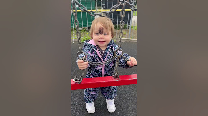 Little Girl Gets Birthmark Removed 💞