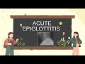 Acute epiglottitis causes, pathogenesis, clinical features,differential,treatment,ospe practice,bcqs