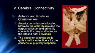 Lecture #18 Hemispheric Specialization  Myth Busting & Anatomical Differences Profile