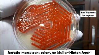 Beautiful colony of bacteria Serratia marcescens