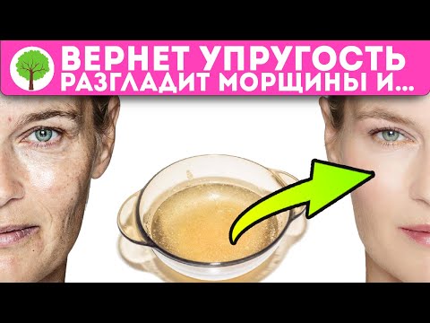 Видео: Pityrosporum Folliculitis: естественное лечение, лицо и многое другое