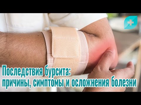 Последствия бурсита: причины,