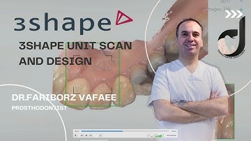 3shape unit scan and design tutorial (part1)