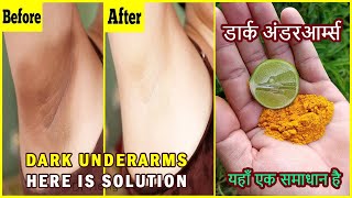 Whiten Dark Underarms Naturally In Short Time | 100% Works At Home
