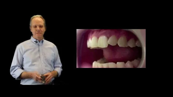 Occlusal Disease Lecture - Dr. Brian Mills