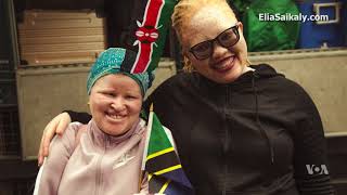 Climb for Albinism: 6 Women Challenge Stereotypes on Africa's Highest Peak