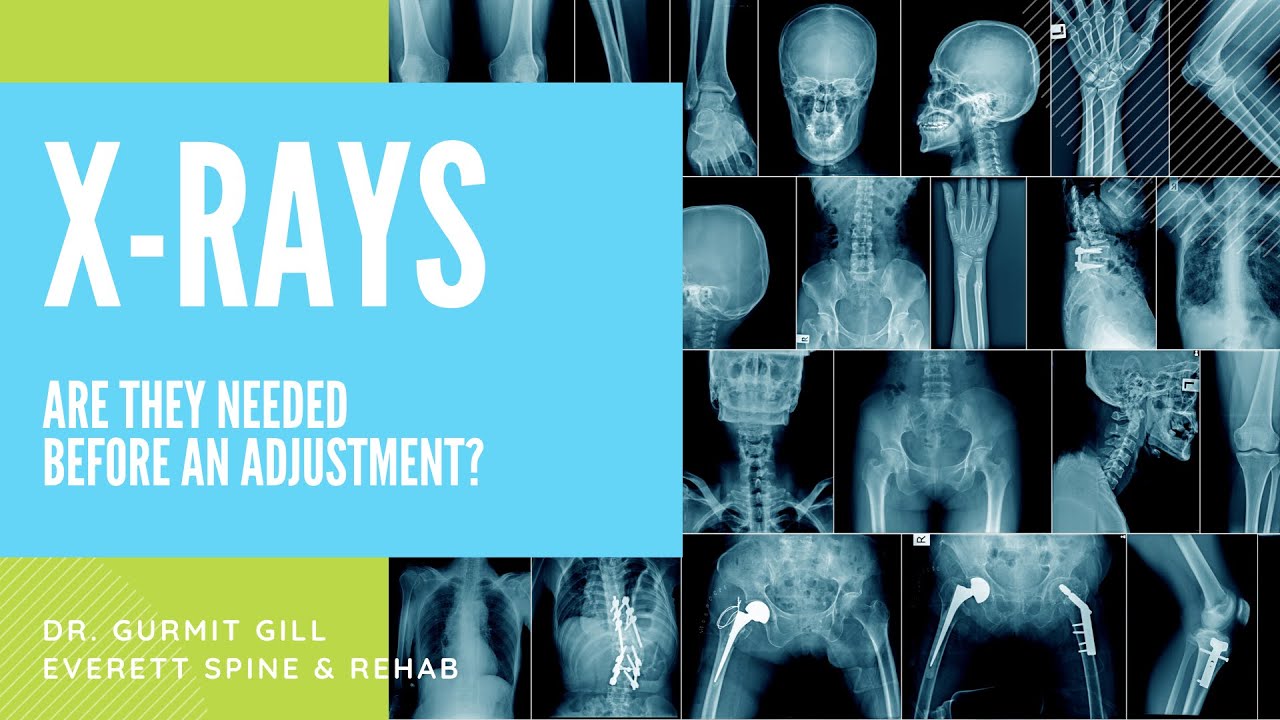 Are X rays Necessary For A Chiropractic Adjustment YouTube Are X rays Necessary For A Chiropractic Adjustment YouTube