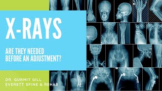 Are x-rays necessary for a chiropractic adjustment?