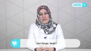 Deri İitihabı Nedir?