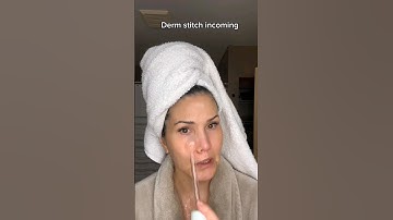 Dermatologist: Are HIGH FREQUENCY WANDS really WORTH IT? #highfrequencywand #acne #derm #skincare