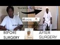 Dbs surgery for tourette syndrome  drparesh doshi