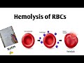 Hemolysis of RBCs # blood physiology lecture - 3 #medico #bestmedicalcollegeinindia