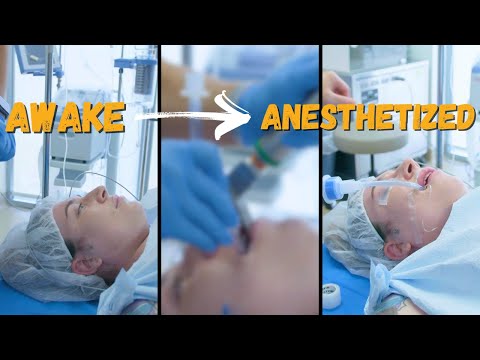 Going from Awake to Under General Anesthesia