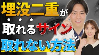 【院長が丁寧に解説】埋没二重が取れる原因は？取れない方法も教えます！！【二重整形】