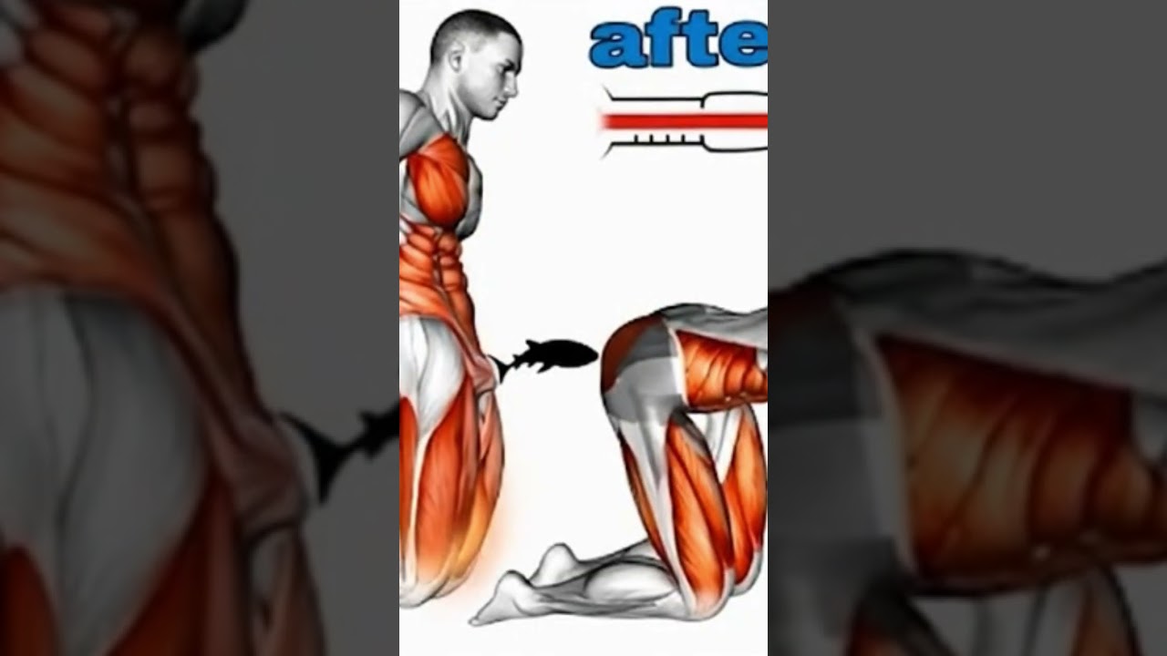 sciatica relief | sciatica pain | relief sciatica pain with exercise 