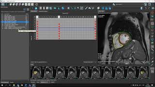 MR explained: Function Analysis screenshot 1