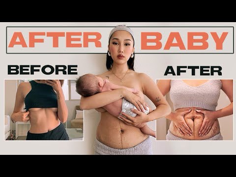 THIS IS MY POSTPARTUM BODY 😱 | Boob Job After Baby, Postpartum Depression...