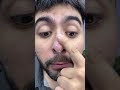 Muy recomendado estos DÚO Hypochlorous Acid Rice Peel Shot pero el precio puede cambiar en cualquier