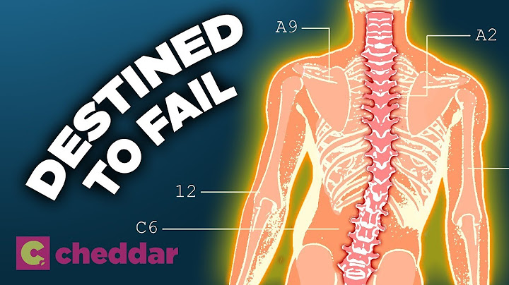 The Human Back Is A Design Disaster - Cheddar Explores