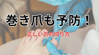 巻き爪を治すワイヤー矯正法は南与野駅徒歩8分のさいたま中央フットケア整体院にお任せ！