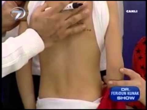 Dr. Feridun Kunak Show B3 (Boyun Ağrıları için Egzersizler)