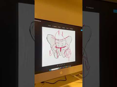 ألم منطقة العانة أسفل البطن علاج طبيعي طب اكسبلور ترند تيك توك  