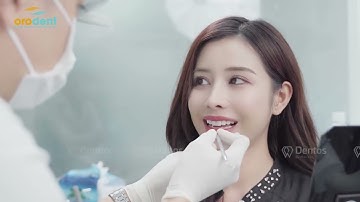 Orodent Bleach & Tiktoker Phương Dung - Rạng rỡ nụ cười, tự tin toả sáng