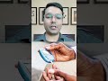 How to Reduce diabetes within 21 days NATURALLY | how to do diabetes control | Dr.Madhusudan