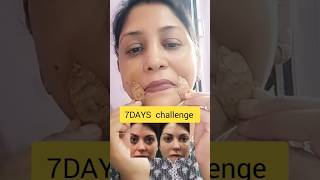 7DAYS challenge!! Ginger is a natural substitute to remove smile line apply for 5 minutes days