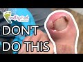 INGROWN NAIL HOME REMEDY GONE BAD!! DO NOT TRY THIS AT HOME