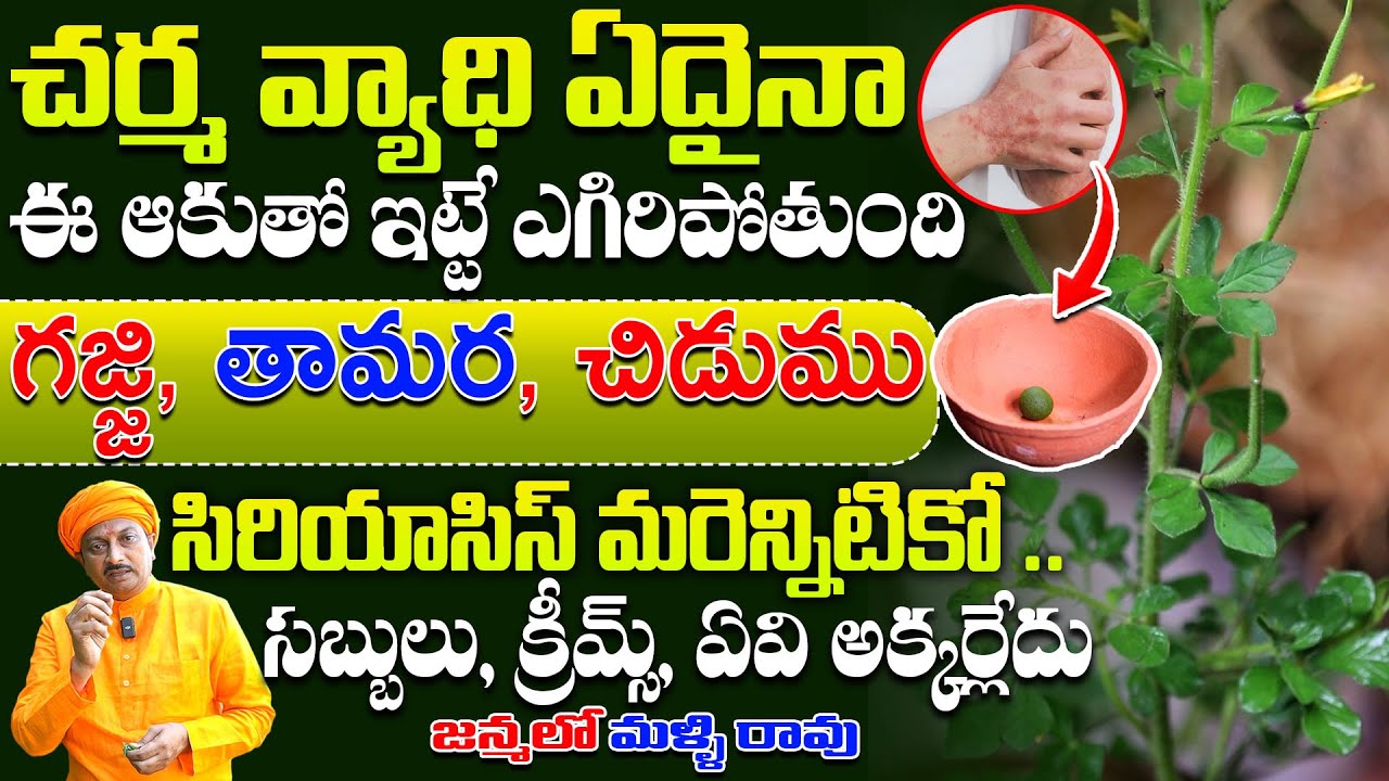 చర్మ వ్యాధి ఏదైనా ఈ ఆకుతో ఇట్టే ఎగిరిపోతుందిగజ్జి, తామర, చిడుముసిరియాసిస్ మరెన్నిటికో |Dr. Ravivarma