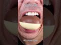 Satisfying Chewing ASMR #Compilation #ASMR #DoctorTristanPeh