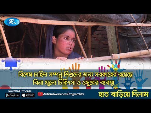 বিশেষ চাহিদা সম্পন্ন শিশুদের জন্য সরকারের রয়েছে বিনা মূল্যে চিকিৎসা ও ওষুধের ব্যবস্থা