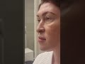 Круговая блефаропластика – хирургическая операция, которая улучшает внешний вид век #блефаропластика