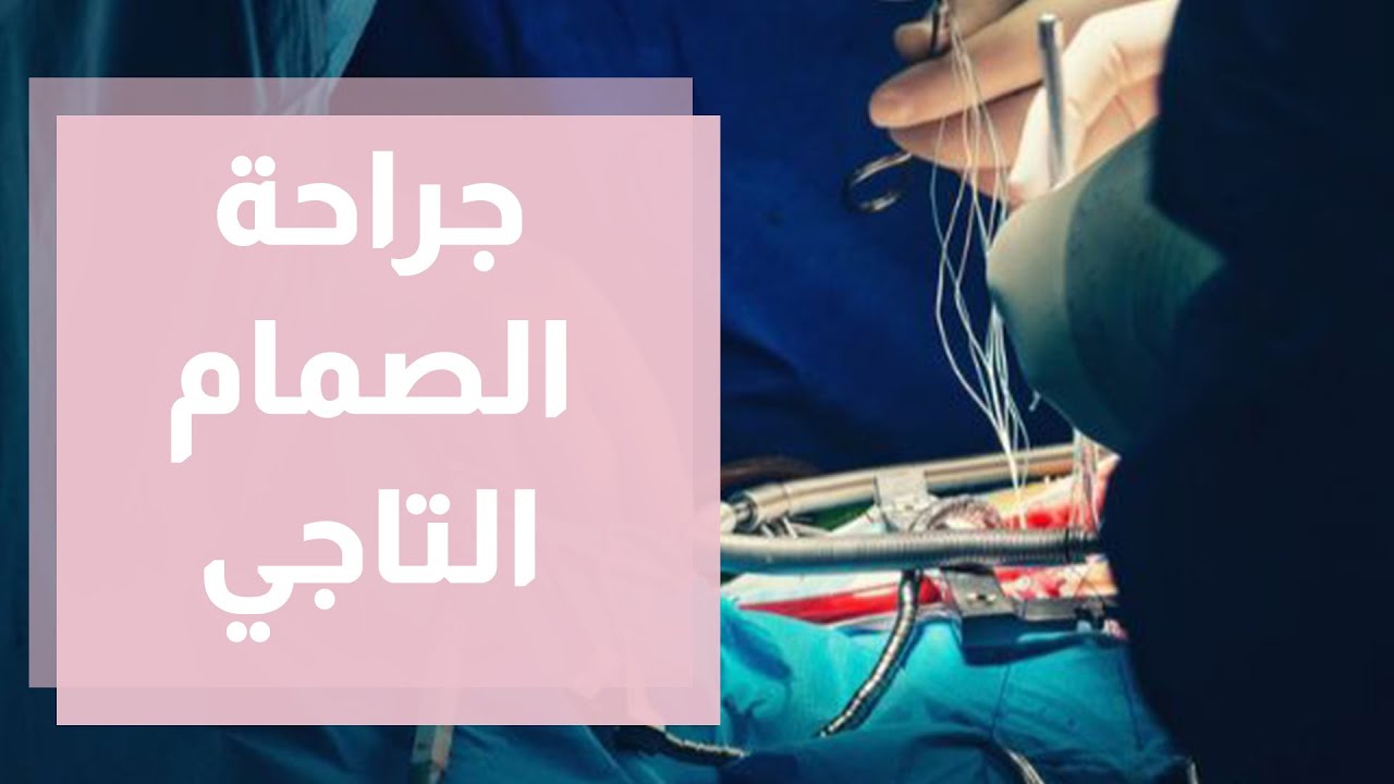 ماذا يجب أن تعرف عن جراحة الصمام التاجي بالمنظار ؟