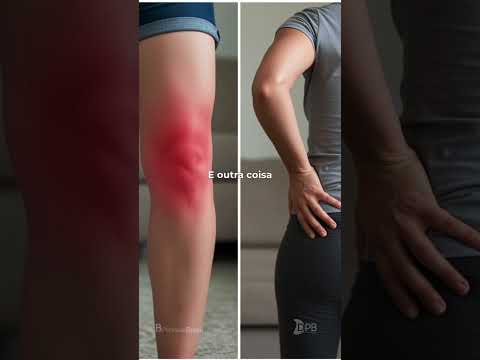 Video Pergunte ao Dr. | O que é Artrite Psoriásica?