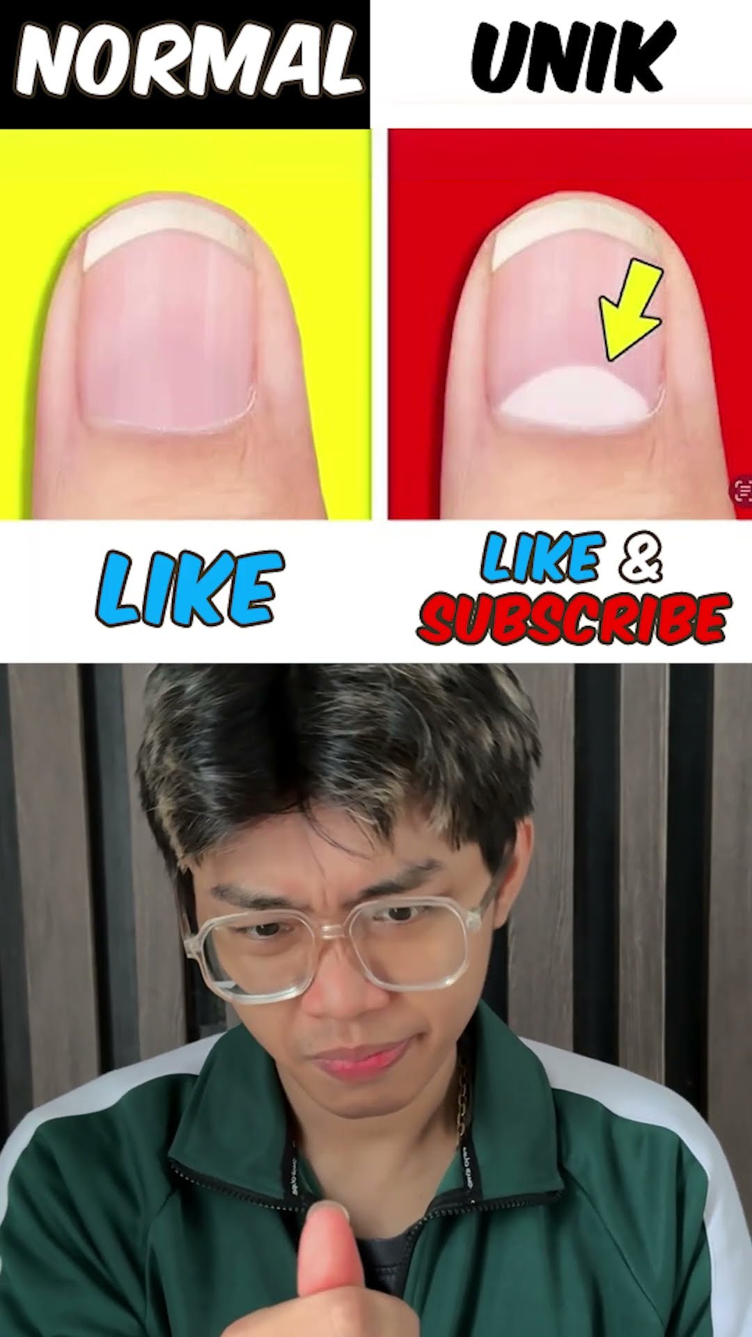 jempol normal atau unik