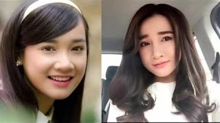 Nhã Phương thừa nhận phẫu thuật thẩm mỹ