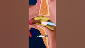 O cotonete pode deixar surdo #shorts