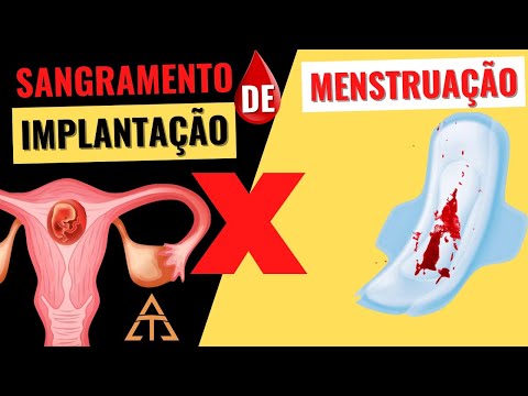 SANGRAMENTO DA IMPLANTAÇÃO DO EMBRIÃO (NIDAÇÃO) x MENSTRUAÇÃO: saiba como diferenciar!