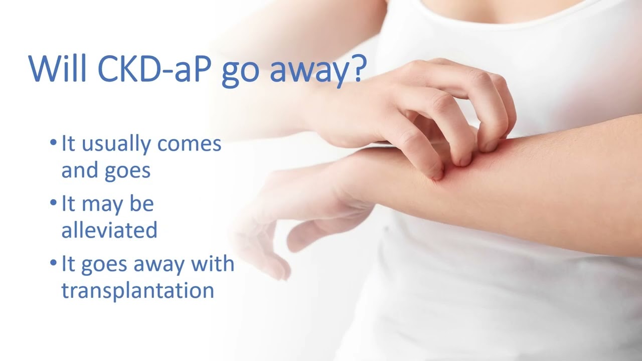 Stop the Itch Understanding Chronic Kidney DiseaseAssociated Pruritus