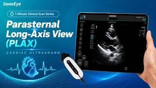 Parasternal Long-Axis View (PLAX) | 1-Minute Clinical Scan Series
